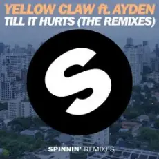 Yellow Claw - Till It Hurts Ft. Ayden (Mr. Belt & Wezol Remix)